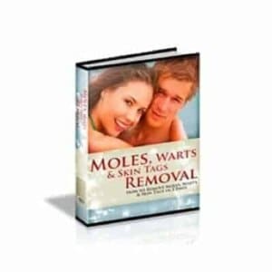How to remove moles, warts and skin tags